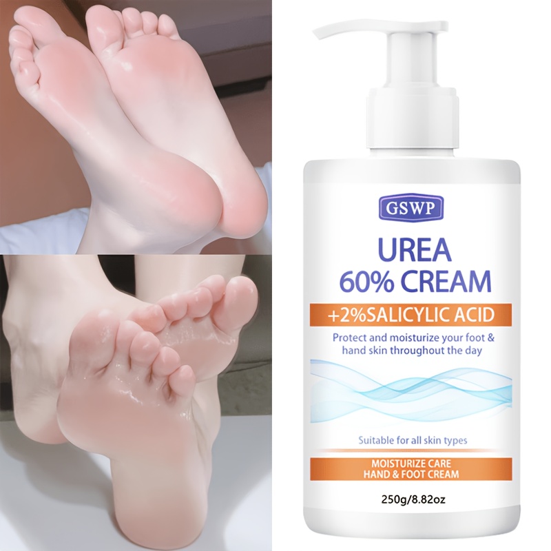Azelaic Acid Cream - GSWP 60% Urea Feuchtigkeitscreme für Hände