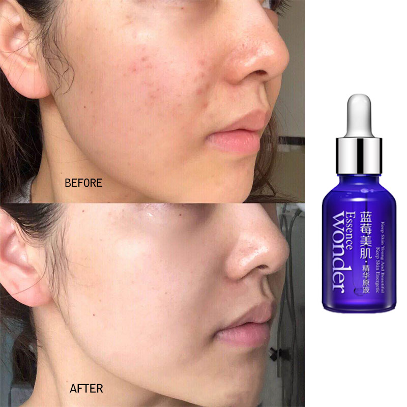BIOAQUA Heidelbeere Gesicht Li – Skincare Bioaqua Bewertung und Preis