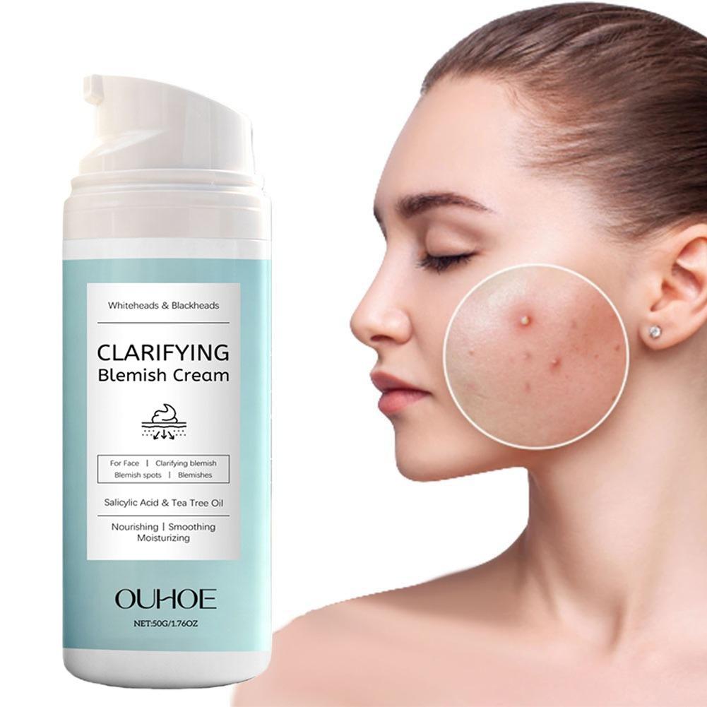 Salicylsäure-Gesichtscreme für – Azelaic Acid Cream Bewertung und Preis