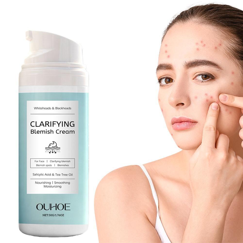Salicylsäure-Gesichtscreme für – Azelaic Acid Cream Bewertung und Preis