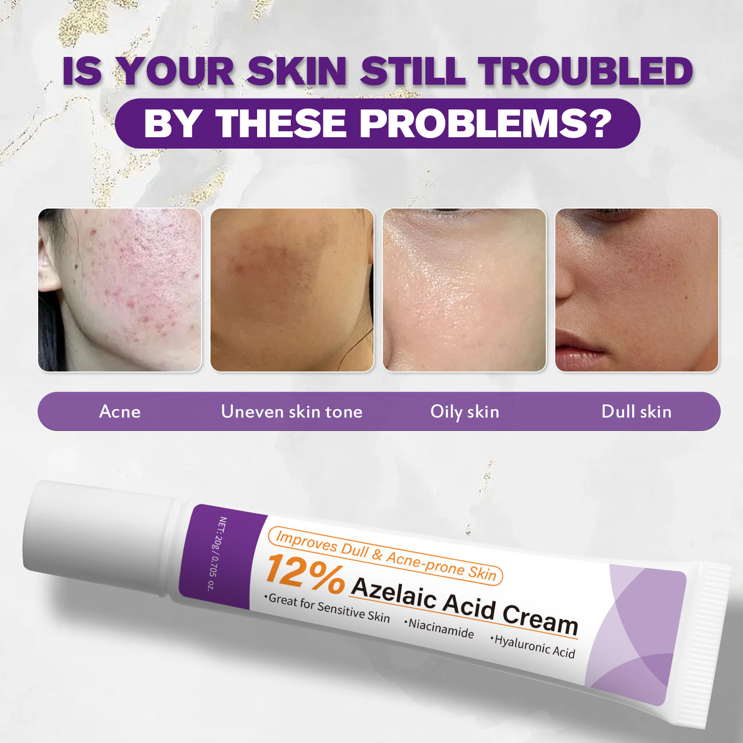 Milde Azelainsäure-Creme verbe – Azelaic Acid Cream Bewertung und Preis
