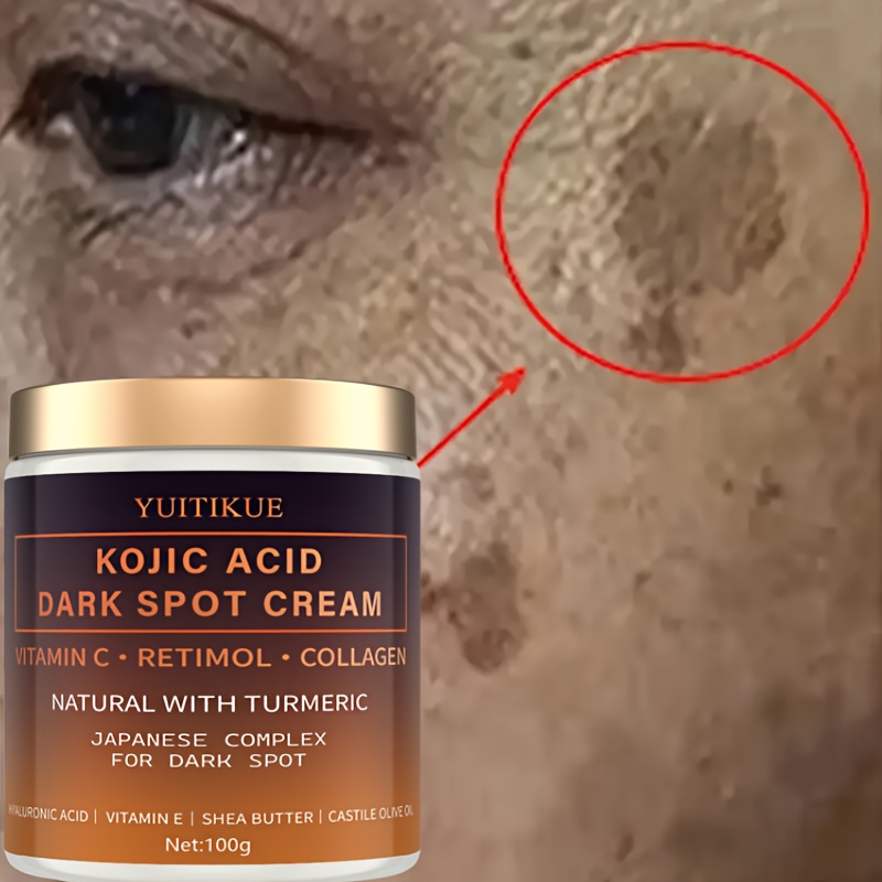 Arbutin-Fading-Creme, Vitamin  – Skincare Vitamin C Bewertung und Preis